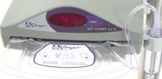 Front view of the 3M™ Ranger™ Fluid Warming System.
